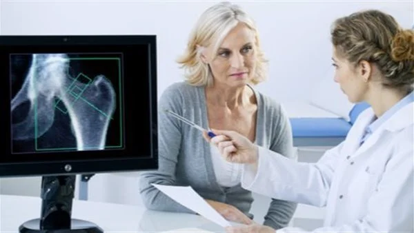 أبرز عوامل الإصابة بهشاشة العظام لدى النساء