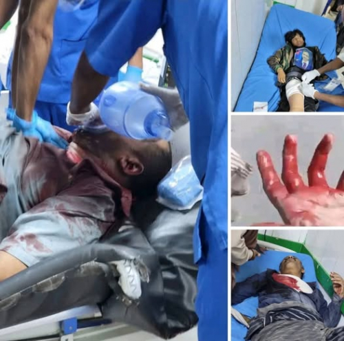 ذباب الرياض يروّج شائعات عن تغييب الزبيدي سياسياً لصرف الأنظار عن مجزرة عتق