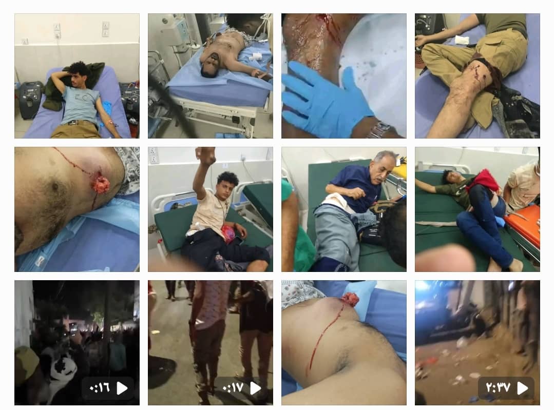 أسماء الشهيد والجرحى الذين سقطوا أمام قصر المعاشيق بعدن