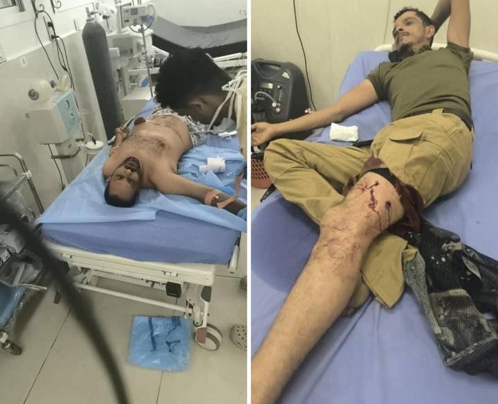 اصابة خمسة اشخاص جراء اطلاق نار أمام بوابة معاشيق